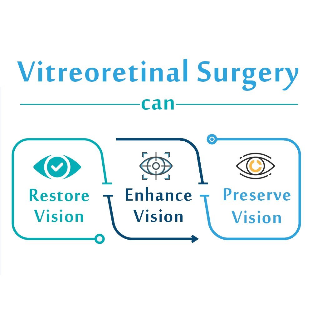 Vitreoretinal Surgery