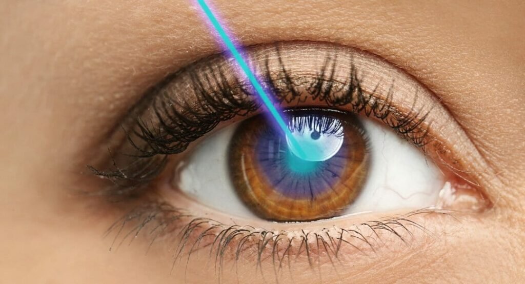 STREAMLIGHT LASIK